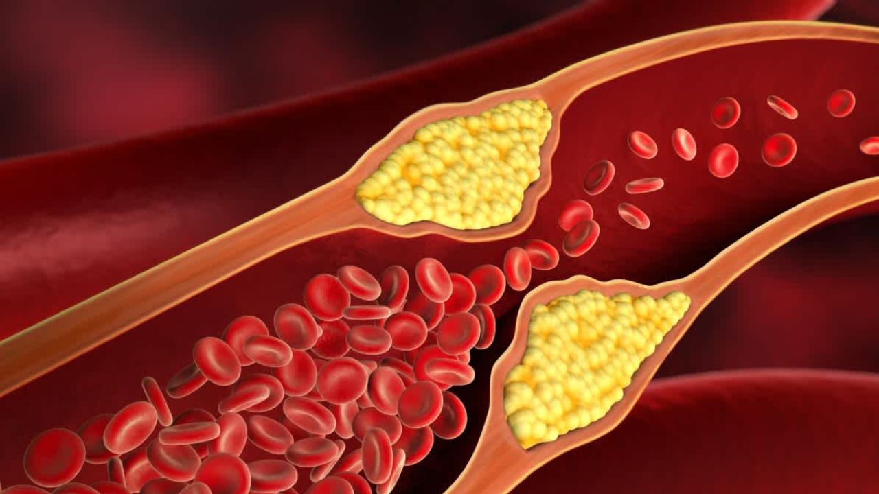 Cholesterol: కొలెస్ట్రాల్ సమస్యను నిర్లక్ష్యం చెయ్యొద్దు.. ఈ ఆహారపు అలవాట్లతో కంట్రోల్ లోకి..