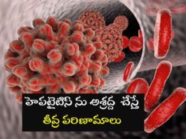hepatitis