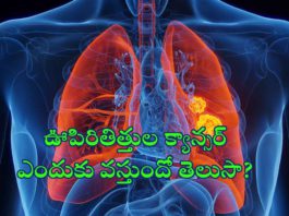 lung-cancer